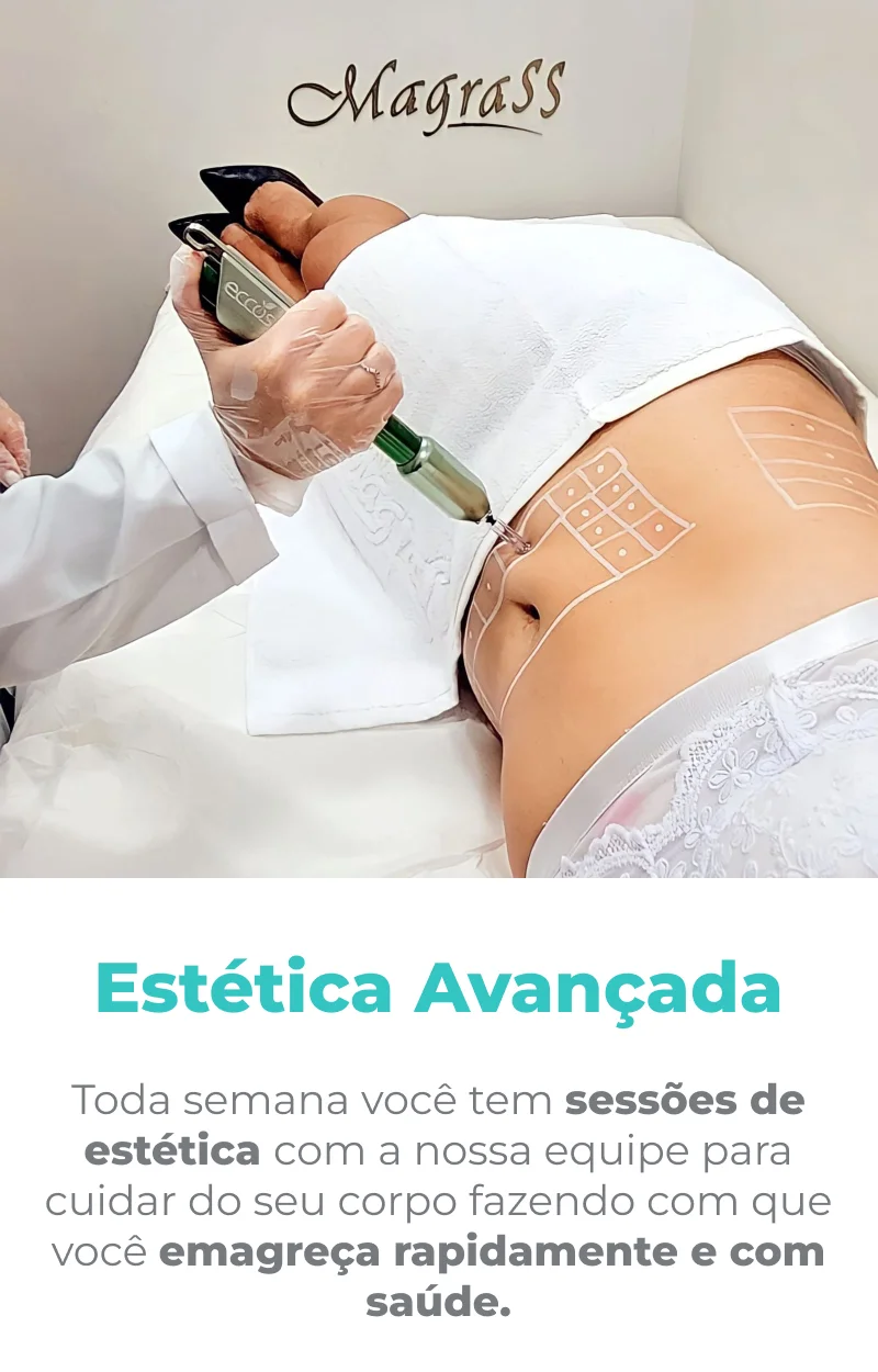 Passo 3: Estética avançada
